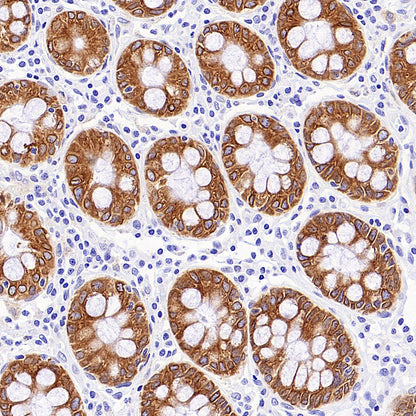 CDS1 Recombinant Rabbit mAb (S-3671-30)