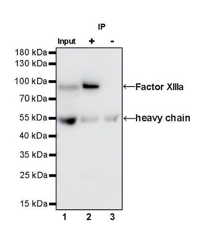S-RMab® Factor XIIIa Recombinant Rabbit mAb (SDT-R278)