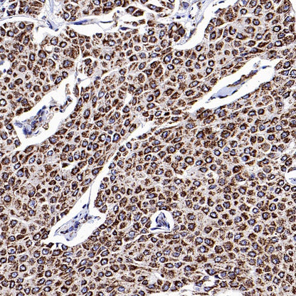 TOMM40 Rabbit Polyclonal Antibody