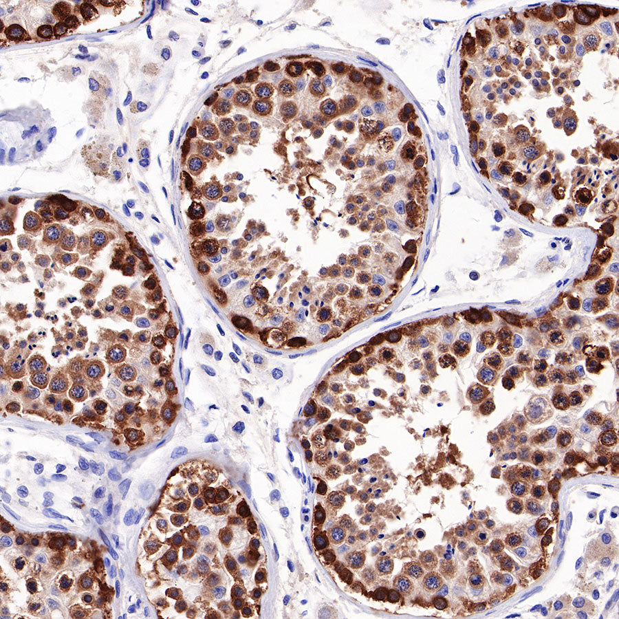 Hsp90 beta Recombinant Rabbit mAb (SDT-359-59)