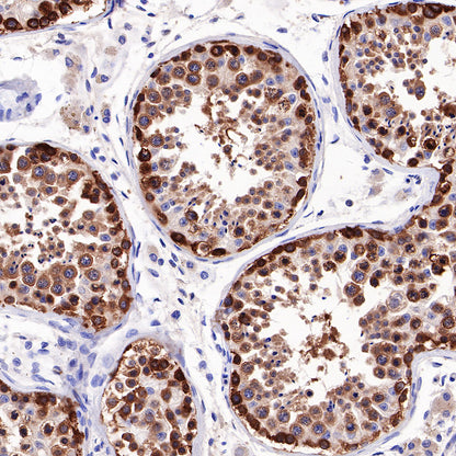 Hsp90 beta Recombinant Rabbit mAb (SDT-359-59)