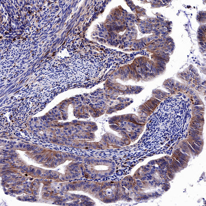 EGFR Recombinant Rabbit mAb (SDT-R110)