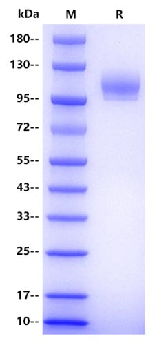 Human CD56 Protein, His tag