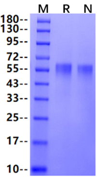 IL-3 Rα/CD123 His Tag Protein, Cynomolgus