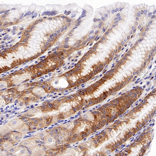 TIM-1 Recombinant Rabbit mAb (S-1555-147)