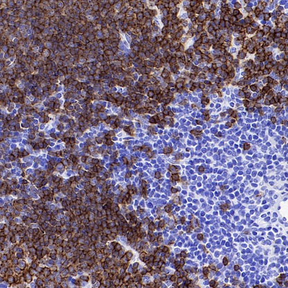 CD19 Recombinant Rabbit mAb (S-3357)