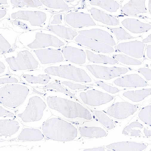 NKX2.2 Recombinant Rabbit mAb (SDT-898-41)