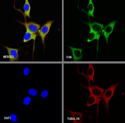 FAK Recombinant Rabbit mAb (S-1180-10)