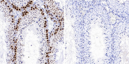 Phospho-gamma H2A.X (Ser139) Recombinant Rabbit mAb (S-981-56)