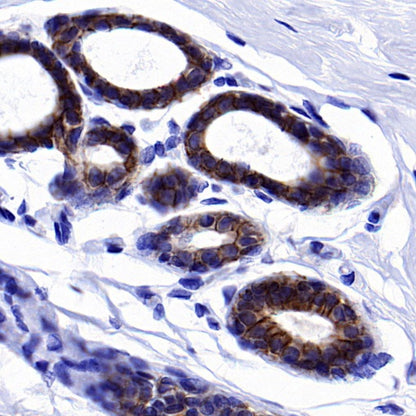 ErbB3 Recombinant Rabbit mAb (SDT-991-73-2)