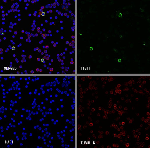 TIGIT Recombinant Rabbit mAb (S-4600)