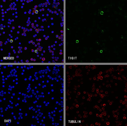 TIGIT Recombinant Rabbit mAb (S-4600)