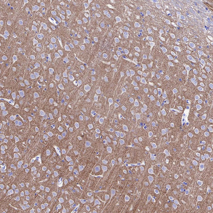 pan SCN Recombinant Rabbit mAb (S-5038)