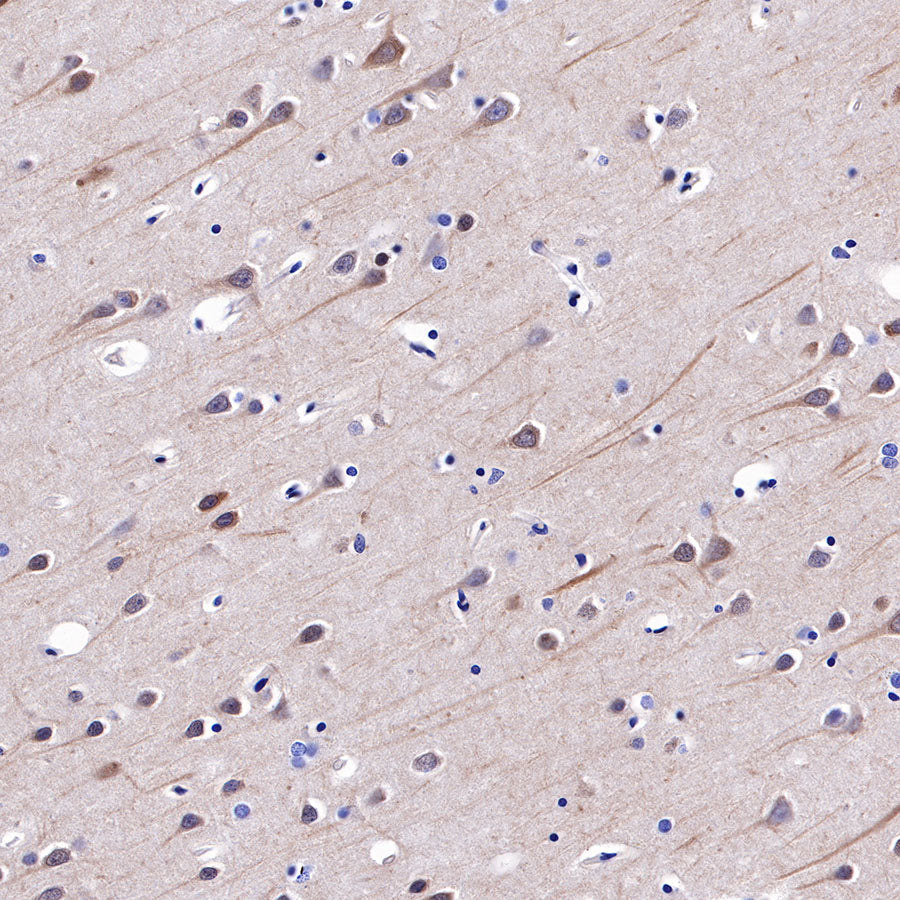 Hsp90 beta Recombinant Rabbit mAb (SDT-359-59)