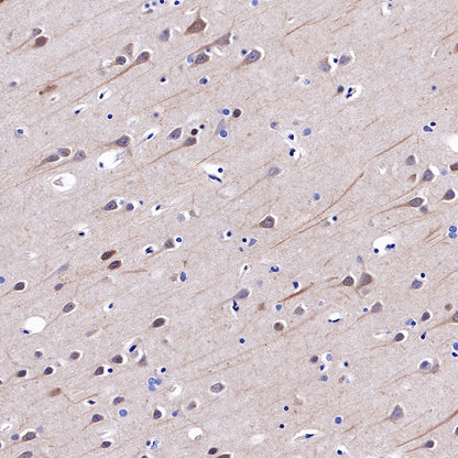 Hsp90 beta Recombinant Rabbit mAb (SDT-359-59)