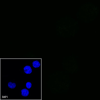 CD21 Mouse mAb (S-764-18)