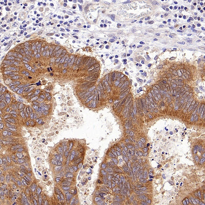 SLC12A2 Recombinant Rabbit mAb (S-2437-30)