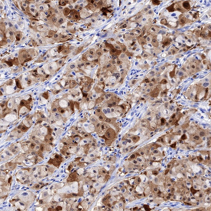 S-RMab® GST-π Recombinant Rabbit mAb (SDT-561-78)