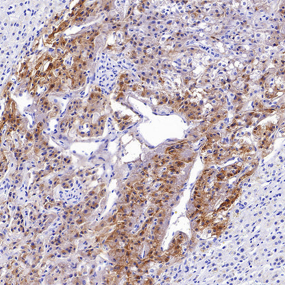 Ret Recombinant Rabbit mAb (S-5298)