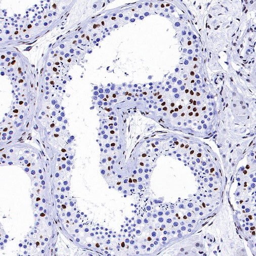 MeCP2 Recombinant Rabbit mAb (S-1884-28)