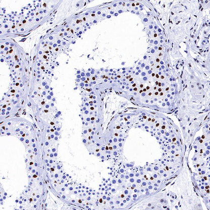MeCP2 Recombinant Rabbit mAb (S-1884-28)