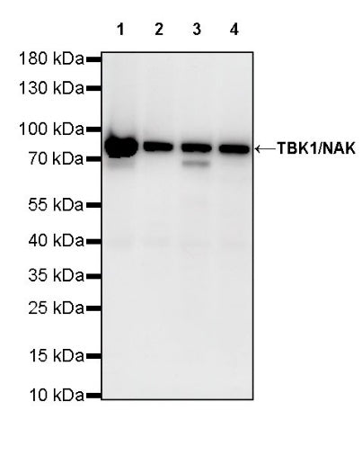 TBK1/NAK Recombinant Rabbit mAb (S-658-50)
