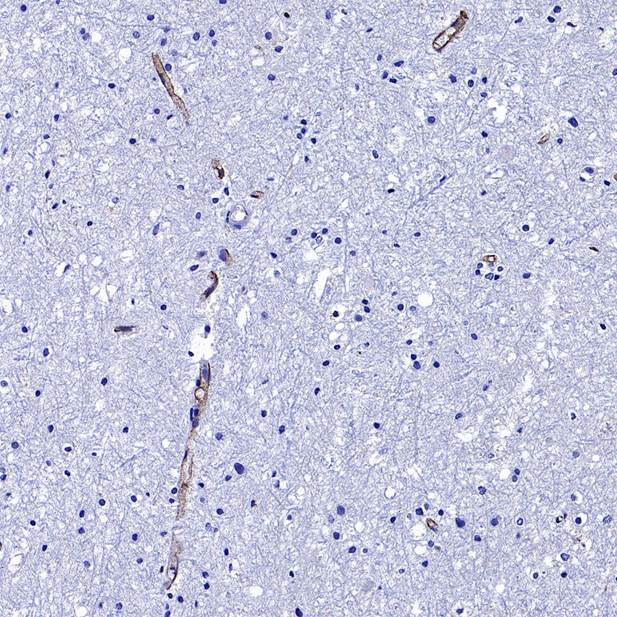 Transferrin Receptor Recombinant Rabbit mAb (S-4791)