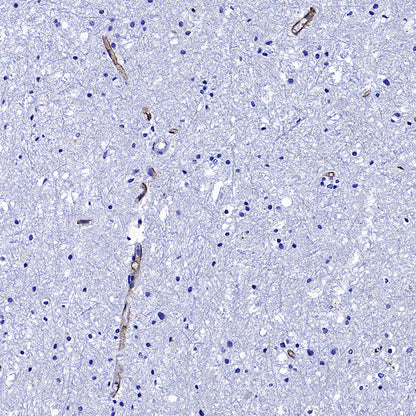 Transferrin Receptor Recombinant Rabbit mAb (S-4791)