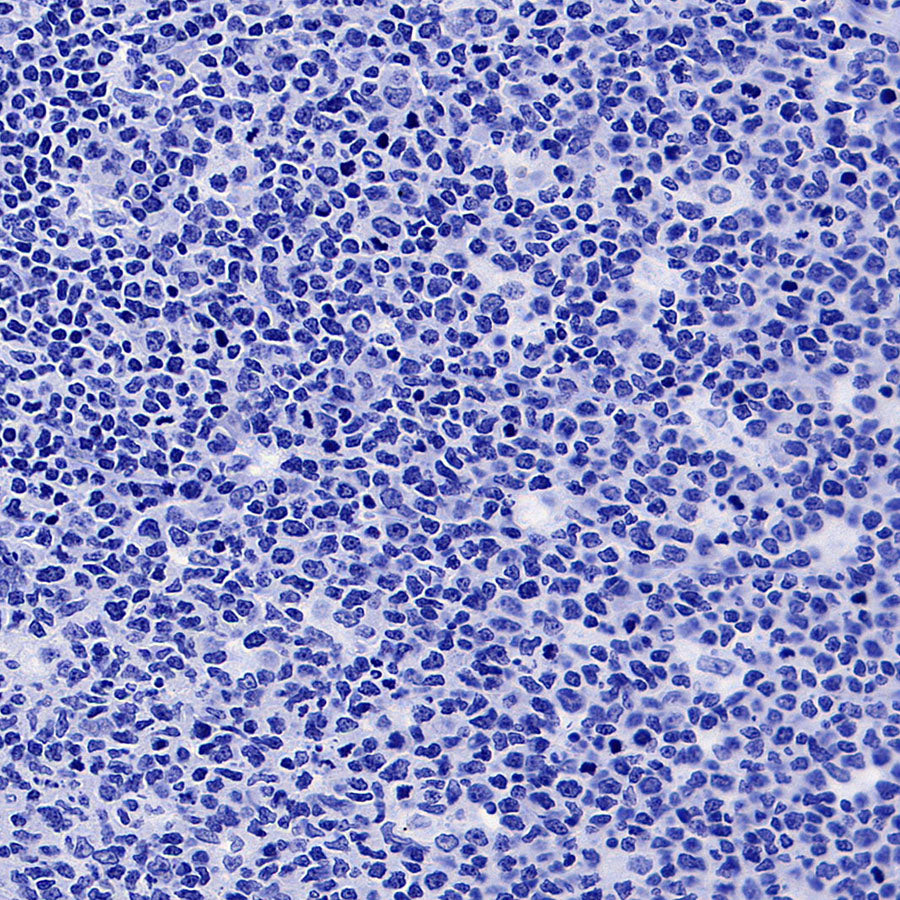 POU2F3 Recombinant Rabbit mAb (S-5525)
