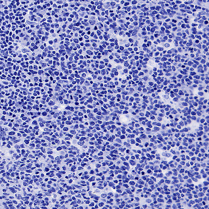 POU2F3 Recombinant Rabbit mAb (S-5525)