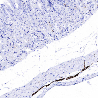 GFAP Recombinant Rabbit mAb (SDT-306-10)
