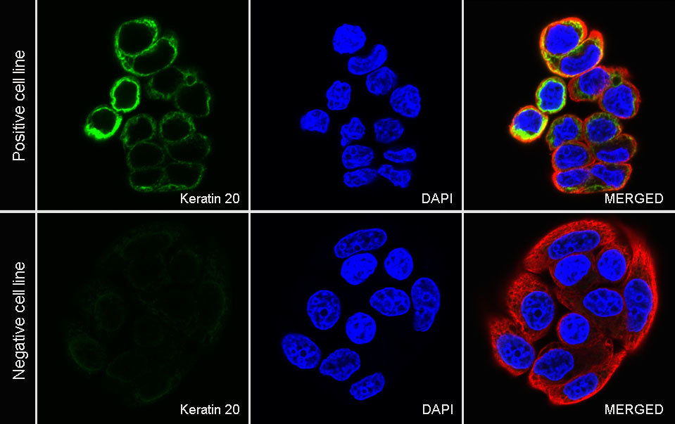 Keratin 20 Recombinant Rabbit mAb (SDT-013-18)