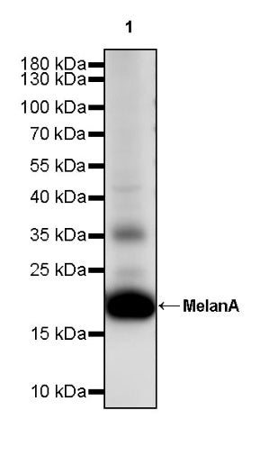 MelanA Recombinant Rabbit mAb (SDT-3352)