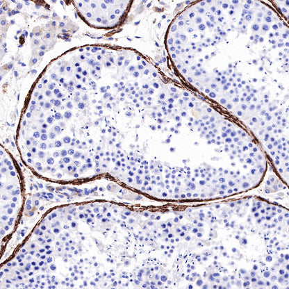 Myosin-11/SMMHC Recombinant Rabbit mAb,PBS Only (SDT-188-112)