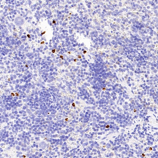 PAD4 Recombinant Rabbit mAb (SDT-2416-3)