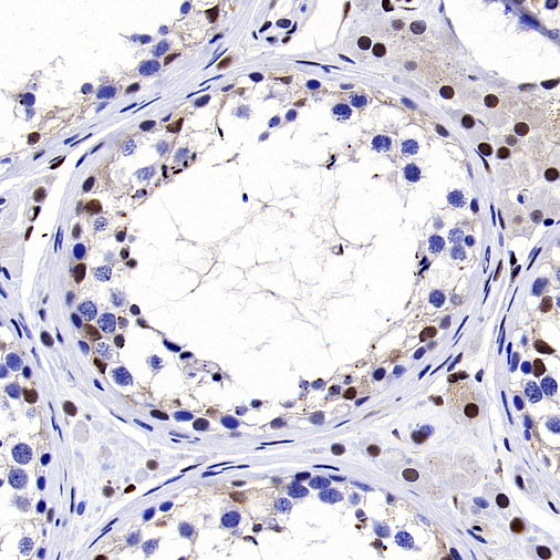 p27 Kip1 Recombinant Rabbit mAb (SDT-361-324)