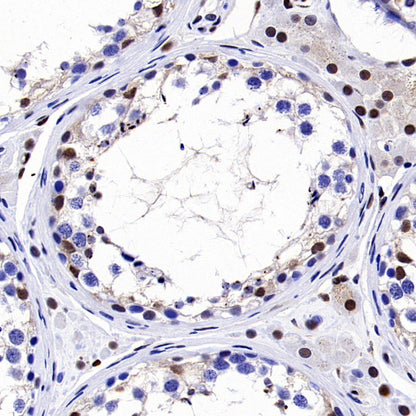 p27 Kip1 Recombinant Rabbit mAb (SDT-361-324)