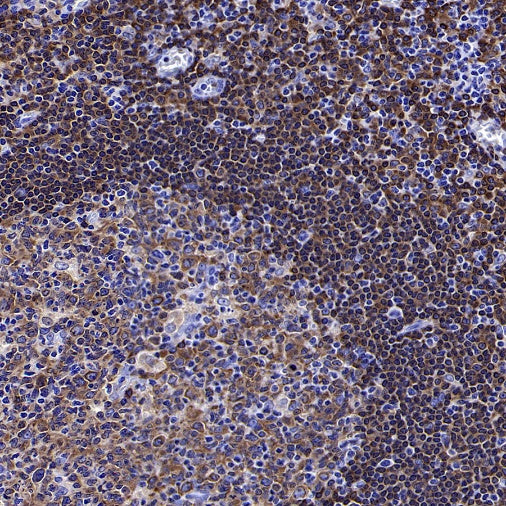 BTK Recombinant Rabbit mAb (SDT-2105-37)