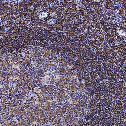 BTK Recombinant Rabbit mAb (SDT-2105-37)