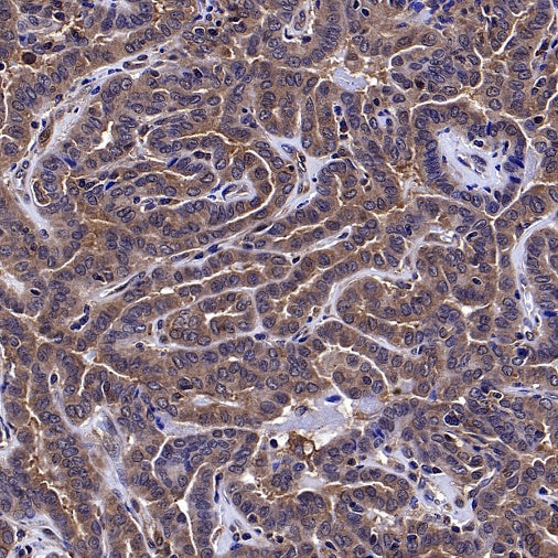 mTOR Recombinant Rabbit mAb (S-698-228)