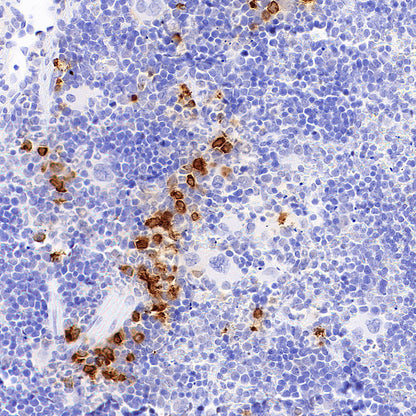 Neutrophil Elastase Recombinant Rabbit mAb (S-4397-22)