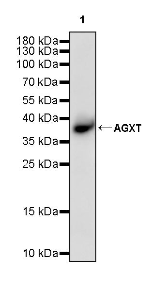 AGXT Recombinant Rabbit mAb (S-3586-30)