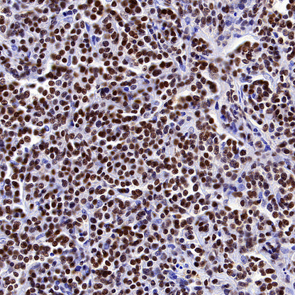 MEF2B Recombinant Rabbit mAb (S-3788-28)
