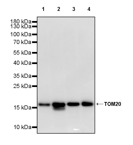 TOM20 Recombinant Rabbit mAb (S-M0015)