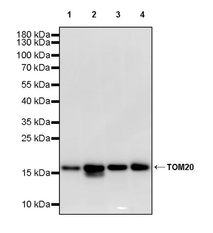 TOM20 Recombinant Rabbit mAb (S-M0015)