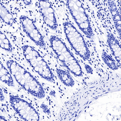 Claudin18.2 Recombinant Rabbit mAb,PBS Only (SDT-102-24)