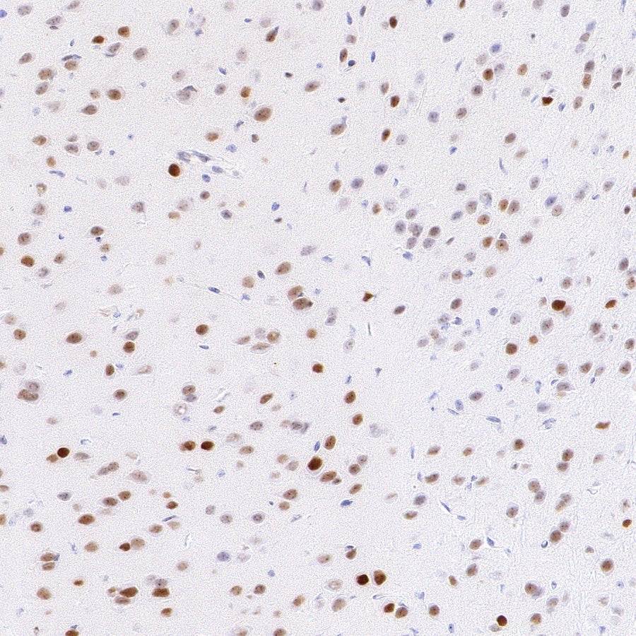 JUND Recombinant Rabbit mAb (S-4270-48)