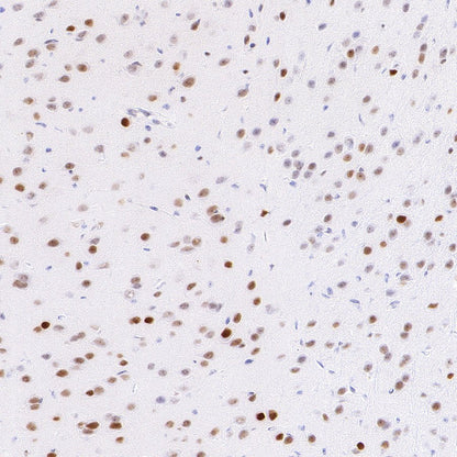 JUND Recombinant Rabbit mAb (S-4270-48)