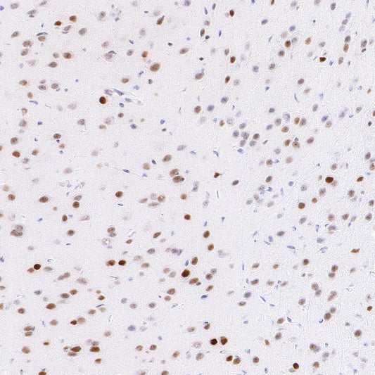 JUND Recombinant Rabbit mAb (S-4270-48)