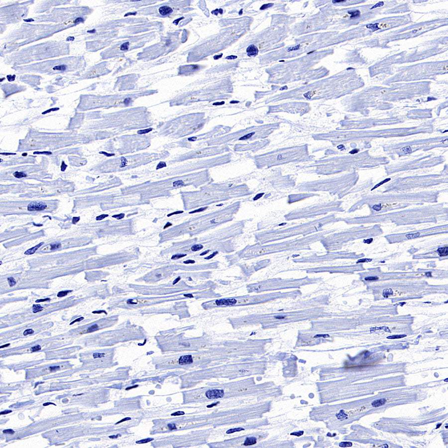 Glypican-3 Recombinant Rabbit mAb (SDT-4064-69)